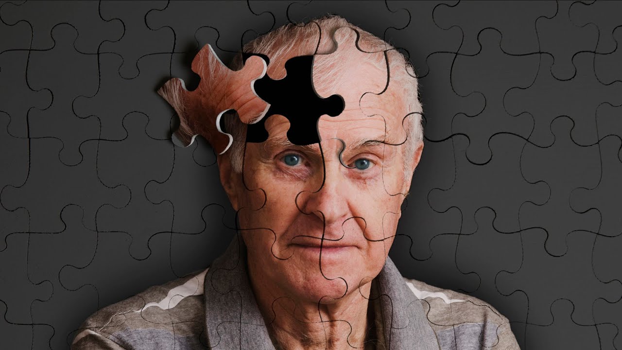 Beyni gençleştiren, Alzheimer riskini azaltan besinler