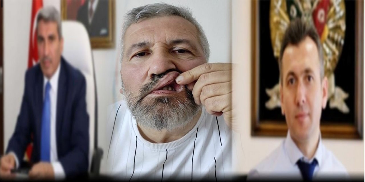 Milli Eğitim Müdürü Yüzünden Saldırıya Uğradı