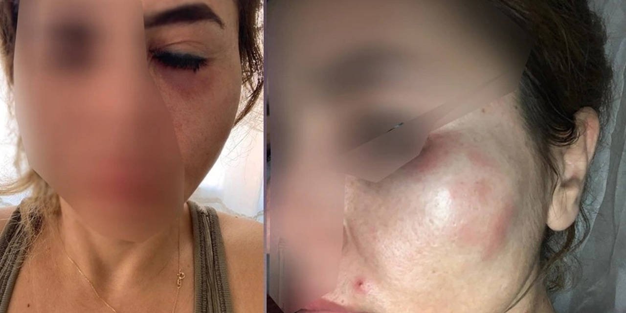 Darp edilen öğretmen kenti terk etmek zorunda kaldı