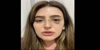 Eşi Tarafından Darp Edilen Öğretmen Yardım Talep Ediyor